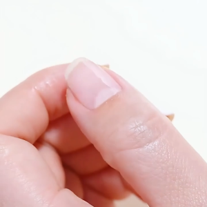 serum penghilang jamur kuku Z4 / nail serum penghilang jamur kuku