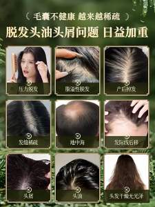 SHUIMUHUACAO | Herbal Anti-Hair Loss And Oil-Control Shampoo Soap