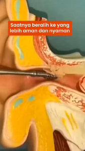 Set Alat Pembersih Korek Kuping Telinga Stainless Paket 5in1