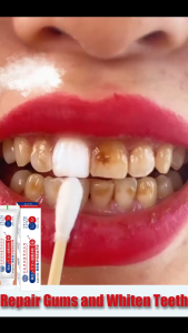 SG(Ready Stock)Japan Regenerated Silicon Whitening Anti-cavity Toothpaste 100g 3-dimensional cleaning power stain removal/antibacterial/strong glaze
