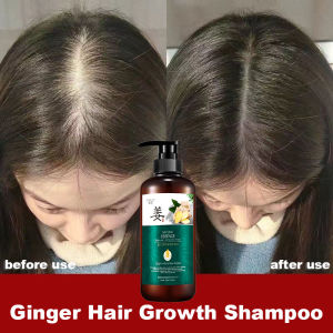 Shampo Jahe 500ml: Solusi Anti Ketombe dan Gatal, Penumbuh Rambut Tebal & Anti Rambut Rontok