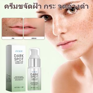 ครีมกำจัดฝ้า กระ จุดด่างดำ รอยสิว รอยหมองคล้ำ เมลานิน ความชุ่มชื้น ดูแลผิวไฝอย่างรวดเร็ว