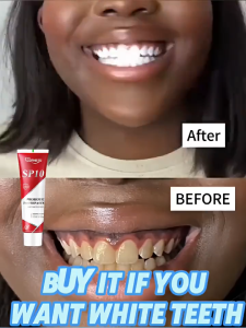 【BUY 1 TAKE 1】SP10 Probiotic Stain Removal Toothpaste Teeth Whitening Removes Yellowing Long Lasting Fresh Breath Probiotic Toothpaste 100g