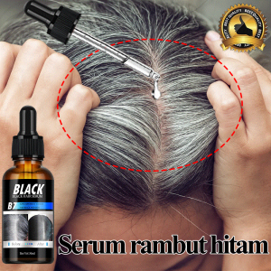 Serum rambut hitam 30ml Obat uban hilang permanen Penghitam rambut uban permanen Anti uban permanen