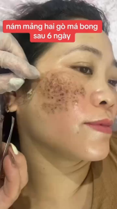 Kem Làm Sáng Da Giảm Thâm Nám Mờ Đốm Nâu Cải Thiện Sắc Tố Da Mang Lại Làn Da Mịn Màng Và Rạng Rỡ Từ Sâu Bên Trong