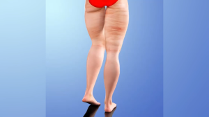 West&Month  Leg Care Patch   Gentle Moisturizing Skin Tightening Leg Daily Body Care Beauty Body