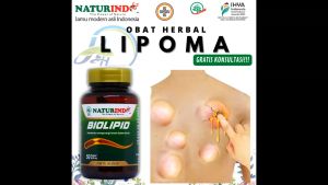 Jamu Biolipid Alami: Obat Herbal Penghancur Lipoma & Penghilang Benjolan Lemak Kulit