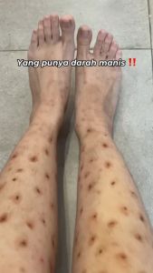 Bundling Collagen Pore Minimizer Serum + Body Serum 30ml