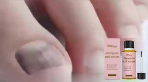 南之月 | Huyết Thanh Dưỡng Móng Phục Hồi Móng Khô Nứt Trị Nấm Tinh Chất Dưỡng Chất Dầu Dưỡng Biểu Bì Làm Chắc Khỏe Móng Tay Chân