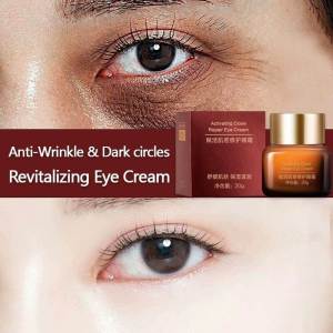 eye bag removal Eye Cream Anti-Wrinkle Fades wrinkles repair fat particles Eye Care eyebags remover