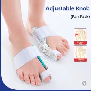 FROTH | Hallux Valgus Toe Correction Device