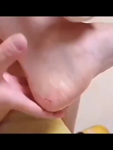 Skin Peeling Cream / atasi kulit kaki kering dan pecah pecah FA