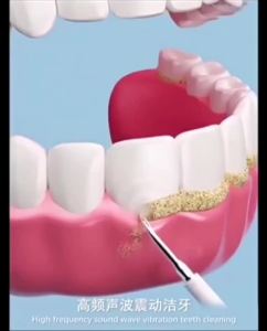 2025 Chính Hãng 1 Năm MànBàn chải đánh răng điện 2 trong 1 giúp cải thiện sâu răng và loại bỏ mảng bám. (Dùng máy tăm nư