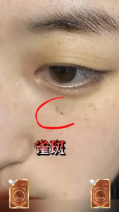 [In Stock] Blackhead and Acne Removal Mask - Lightens Dark Spots Evens Skin Tone Anti-Wrinkle Deep Cleansing Oil Control Mask - 100g