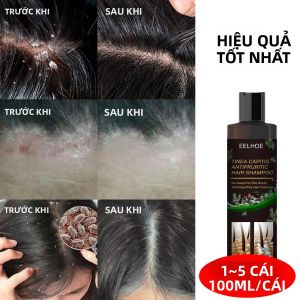 Dầu Gội Thảo Dược Tự Nhiên 100ml Nuôi Dưỡng Sâu Dưỡng Ẩm Chăm Sóc Da Đầu Chống Gàu & Loại Bỏ Ve Chuyên Nghiệp Dầu Gội Dành Cho Mọi Loại Tóc