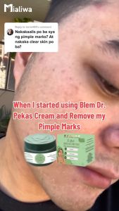 Blem Dr The Ultimate Pekas Cream & Toner Whitening Exfoliating Rejuvenating Moisturizer Face Cream Beauty Skin Care Niacinamide Aloe Vera Calamansi Dark Spot Melasma Freckles Pore Pimple Acne Blackheads Oil Control Anti Aging Glass Skin For Men & Women