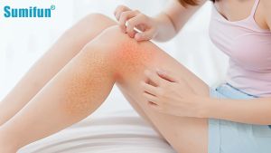 Krim Retakan Kulit Sumifun: Menghaluskan & Melembabkan Kulit