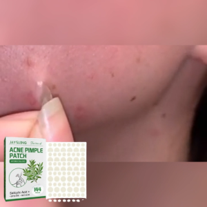 【BUY 1 TAKE 1】Jaysuing Acne Pimple Patch Hydrocolloid Pimple Stickers Waterproof Removal Acne Facial Skin Care 144pcs