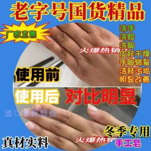 Traditional Handmade Pig Pancreas Soap Exfoliating Oil Removal for Rough Dry Cracked Hands And Feet Frostproof