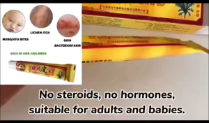 Skin Fungus Cream Eczema Treatment Anti Bacterial