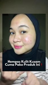 Reglow Serum Perawatan Malam dan Siang Hari Paket Combo Mencerahkan Kulit Wajah Memudarkan Bekas Jerawat dan Flek Hitam BPOM