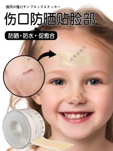 Miếng Dán Chống Nắng Vết Thương Miếng Dán Che Phủ Chống Tia UV Cho Người Lớn Và Trẻ Em Sau Phẫu Thuật Miếng Dán Chống Thâm Đen