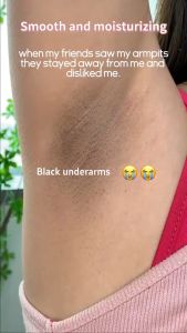 Pemutih Ketiak Hitam Private Parts Whitening Whitening Underarm Whitening Cream Armpit Whitening Cream Body Whitening Cream Legs Knees 美白霜