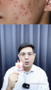 [ยกกล่อง6ซอง]เจลบำรุงผิวหน้า Dragons Blood Acne Scar 7กรัม (6ซอง)