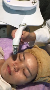 Golden Eye Beauty Machine RF Treatment Eye Bags Machine Under Eye Dark Circle Removal