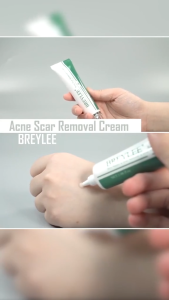 BREYLEE ครีมสมุนไพร ลบรอยแผลเป็นจากสิว แผลผ่าตัด และแผลไฟไหม้ สูตรสมุนไพร ฟื้นฟูผิวให้เรียบเนียน จางลงอย่างเป็นธรรมชาติ remove scar