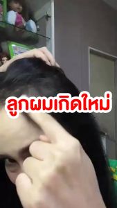 [ส่งฟรี] [ของแท้จากบริษัท] My Organic Hair M1 Hair Serum แฮเซรั่ม แก้ผมหงอก แก้ผมร่วง ผมบาง ผมหงอก