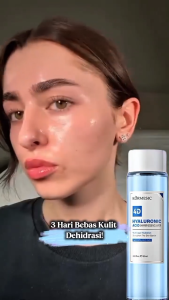 4D Hyaluronic Acid Barrier Essence Toner HYD Booster 120ml | Oily Skin Intensive Hydration Toner Wajah Hydrating Toner Wajah Acne
