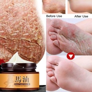 Horse Oil foot care cream for dry cracked heel 30g hand and foot cracked cream repair cracked heels prevent seasonal hand and foot peeling