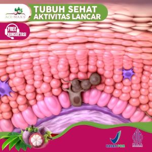 ace max maxs maxs | acemaxs jus kulit manggis+daun sirsak | Bantu atasi Benjolan dan Kista