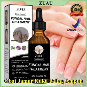 Nail Repair Essence Serum Original Serum Kuku | Perawatan Kuku Berjamur | Serum Penghilang Jamur Di Kuku | Vitamin Kuku Rusak | Memperbaiki Kuku Rusak 30ML