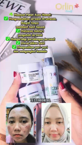 ACNE SERIES ORLIN BEAUTY SKINCARE PAKET ACNE HEMAT ACNE GLOWING