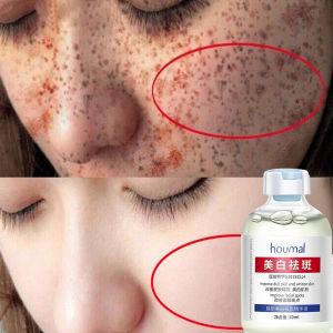 Ready Stock Nicotinamide Whitening Freckle Serum dark spot remover  brighten melanon skincaremoisturizer mild krim jeragat degil berkesan pigmentation50ml烟酰胺美白祛斑霜