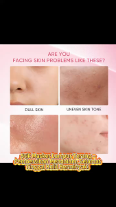 Clay Mask Stick kit - Mugwort Acne Facial Alaska Volcano Blackhead Remover Mud Mask Muka Niacinamide Kulit cerah