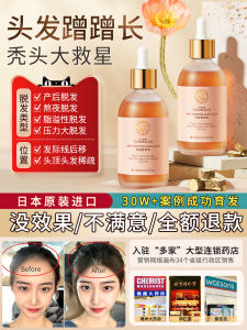 韩方五谷hair tonic 100ml生发液anti hairloss防脱发头发发际线育发营养液剂增发密发快速增长多女生防脱神器生发精华液Serum Fast Hair Growth Serum Hair Tonic For Men Women