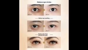EELHOE | 1/2PCS Mercilen 24K Gold Hyaluronic Acid Eye Cream Moisturizing Eye Care Serum Hydrating Anti-aging Creams Eyes Skin Care