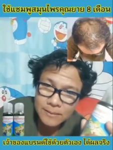 แชมพูสมุนไพรไทย คู่บุคคล 2 ขวด ลด 500 มล ร่วมกับคัน, รังแค เร่งการเกิดผมใหม่