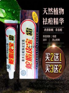 Snake Fat Skin Treasure Cream Acne Treatment Cream Back And Face Acne Removal Blackhead And Closed Comedone Exterminator Student