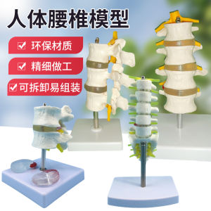 Human Spinal Column Model Vertebra Lumbar Spine Model Disc Joint Pathology Educational Toy Static Model for All Gender