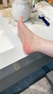 ✅SG Ready Stocks✅JOMO Double Sided Foot File Dead Skin Callus Remover Pedicure Tool Exfoliator