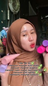 🔥 SnowWhitee Snowy Treatment Lotion Ori - Strawberry Bombshell  HoneyDew   Grape  Peach Losyen Snow White Snowhite