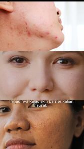 RIVYA Backhousia Sleep Care Infused Serum 20ml | Skin Barrier Brightening Moisturizing Vegan Calming Sensitive Skin Friendly Super Rich Moisturizer Sebum Control