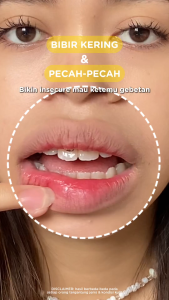 Azarine Glowkiss Sunscreen Lip Balm 3gr Pelembab Bibir SPF 35 PA +++ dengan Ceramide Peptide Vitamin C | Mencerahkan Menghidrasi Melindungi Bibir dari Sinar UV