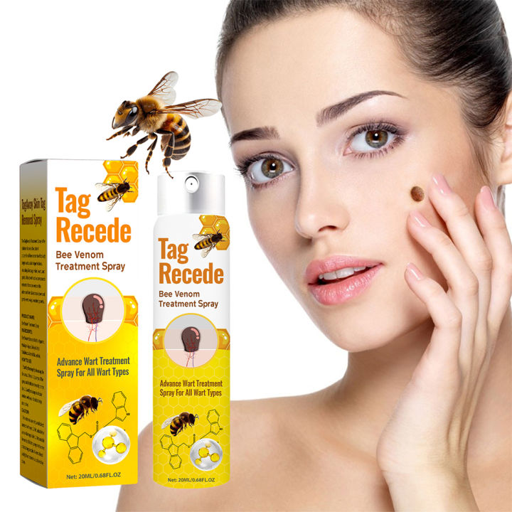 Bee Venom Skin Tag Remover Reviews Consumer Reports Skin tag remover spray bee venom mole wart removal treatment spray 20ml