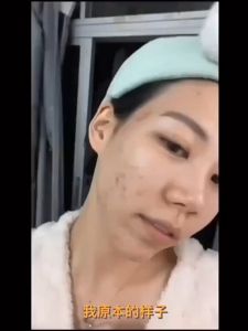 Anti-Acne Repair Essence Double acne powder water Salicylic Acid Oil Control Fade Closed Acid Acne Men and Women Pores Relieve10ml祛痘粉水