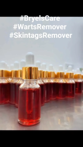 15ml Kasoy Oil Rarts Remover Legit Original Effectively Removes Warts Skintags Moles & Kulogo by GoFit Phils.